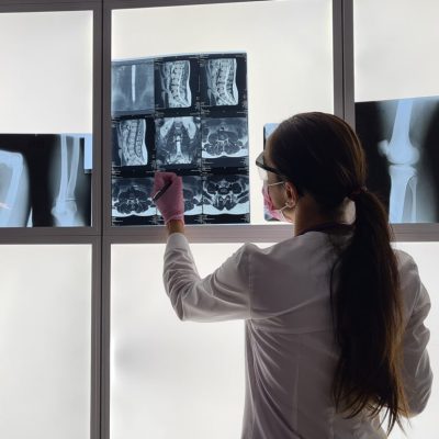 Radiologist checks x-ray image on light box
